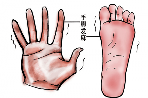 手腳經常發(fā)麻是什么原因?手腳發(fā)麻可能患有哪些疾??？